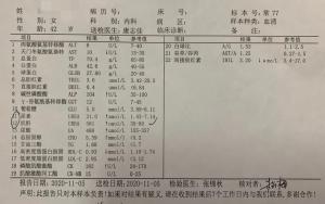 高血压不器沉，，，，，，，，养出了尿毒症